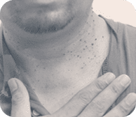 Service Offered: Skin Tags